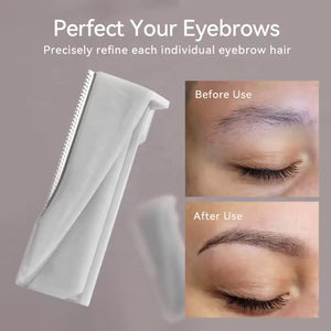 Glassyox Sonic Dermaplaning Device for Facial Exfoliation and Hair Removal