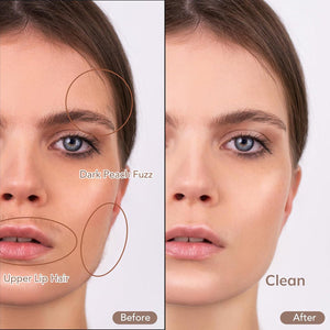 Glassyox Sonic Dermaplaning Device for Facial Exfoliation and Hair Removal