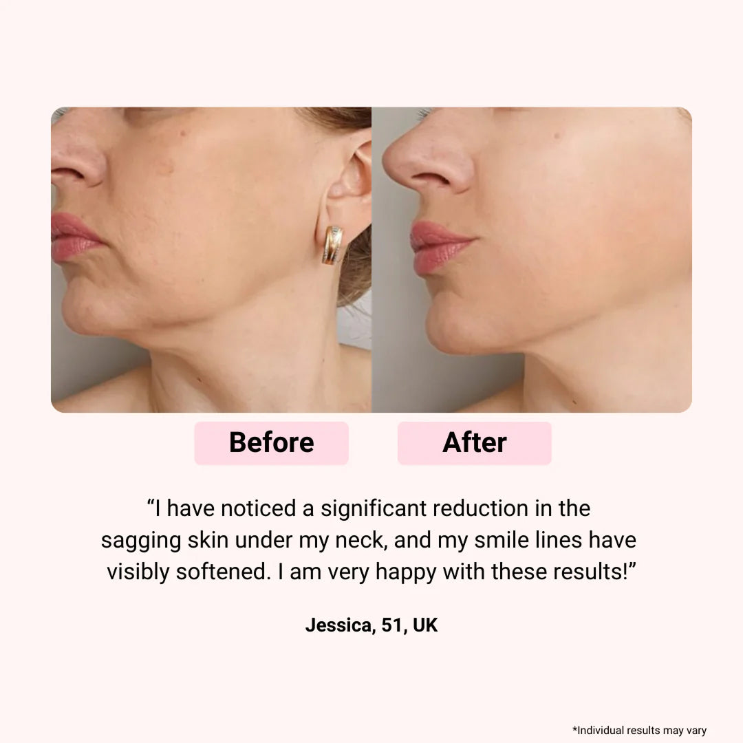 LumieNyxx Professional LED Face Mask for Home Rejuvenation