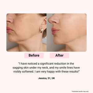 LumieNyxx Professional LED Face Mask for Home Rejuvenation
